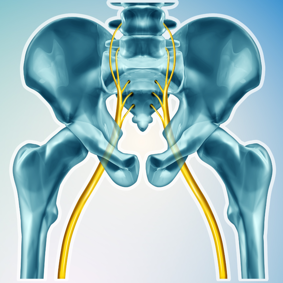 CBD for Sciatic Pain