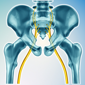 CBD for Sciatic Pain